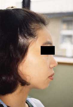 Face