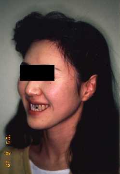 Face