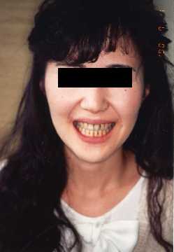Face