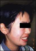 Face