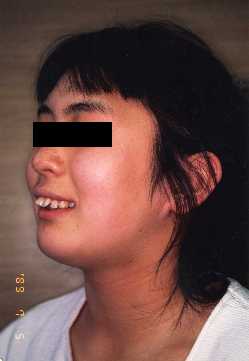 Face