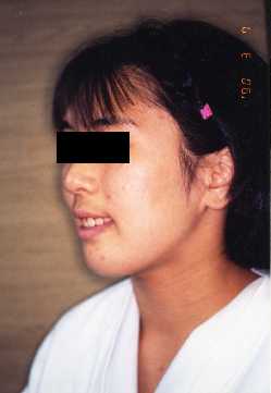 Face