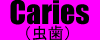 虫歯とは